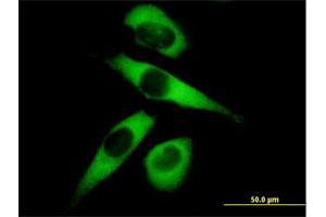 Immunofluorescence of purified MaxPab antibody to MARS on HeLa cell. (Mars (MARS) (AA 1-900) 抗体)