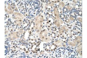 Immunohistochemistry (IHC) image for anti-phosphoserine Aminotransferase 1 (PSAT1) (N-Term) antibody (ABIN2782576) (PSAT1 抗体  (N-Term))