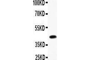 Anti- CEBP Beta Picoband antibody, Western blotting All lanes: Anti CEBP Beta  at 0. (CEBPB 抗体  (AA 1-200))