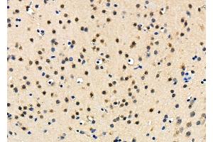 ABIN6265019 and ABIN6278326 at 1/100 staining Mouse brain tissue by IHC-P.