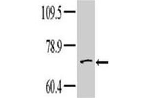 Western blot analysis of TNK1 polyclonal antibody  in HeLa cell line lysate. (TNK1 抗体  (Internal Region))