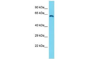 Western Blotting (WB) image for anti-Zinc Finger, CW Type with PWWP Domain 1 (ZCWPW1) (N-Term) antibody (ABIN2791107) (ZCWPW1 抗体  (N-Term))