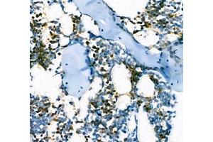 Immunohistochemistry of paraffin embedded mouse bone using AHSP (ABIN7073016) at dilution of 1:300 (400x lens) (aHSP 抗体)