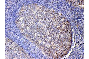 IHC analysis of IL13 using anti-IL13 antibody . (IL-13 抗体  (AA 36-146))