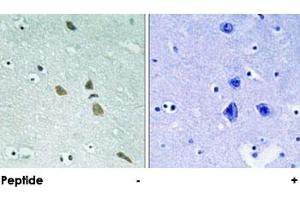 Immunohistochemical analysis of paraffin-embedded human brain tissue using ILK polyclonal antibody . (ILK 抗体)