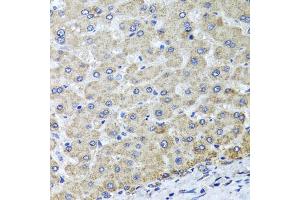 Immunohistochemistry of paraffin-embedded human liver injury using OSGEPL1 antibody (ABIN5974954) at dilution of 1/100 (40x lens). (OSGEPL1 抗体)