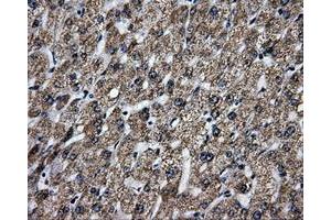 Immunohistochemical staining of paraffin-embedded liver tissue using anti-BRAFmouse monoclonal antibody. (BRAF 抗体)