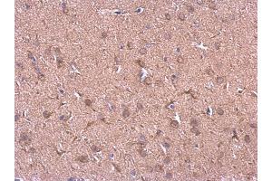 Immunohistochemistry (IHC) image for anti-Heat Shock Protein 90kDa alpha (Cytosolic), Class B Member 1 (HSP90AB1) (Internal Region) antibody (ABIN2855037)