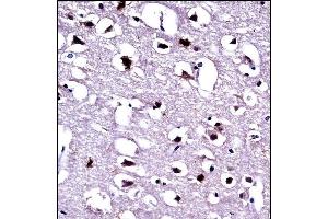 Immunohistochemistry (Paraffin-embedded Sections) (IHC (p)) image for anti-Eukaryotic Translation Elongation Factor 1 alpha 1 (EEF1A1) (AA 361-389), (C-Term) antibody (ABIN390521)
