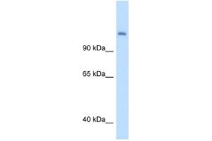 Western Blotting (WB) image for anti-Carbamoyl-Phosphate Synthase 1, Mitochondrial (CPS1) (Middle Region) antibody (ABIN2782319)