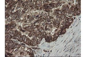 Image no. 7 for anti-Family with Sequence Similarity 164, Member A (FAM164A) antibody (ABIN1498198) (FAM164A 抗体)