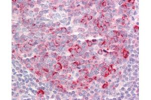 Anti-TSHZ1 antibody IHC staining of human tonsil. (TSHZ1 抗体  (N-Term))