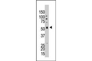 The PPP5C polyclonal antibody  is used in Western blot to detect PPP5C in HL-60 cell lysate. (PP5 抗体  (C-Term))