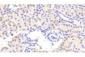 Immunohistochemistry (IHC) image for anti-Solute Carrier Family 40 (Iron-Regulated Transporter), Member 1 (SLC40A1) (AA 127-321) antibody (ABIN7434956)