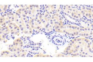 Detection of FPN in Human Kidney Tissue using Polyclonal Antibody to Ferroportin (FPN) (SLC40A1 抗体  (AA 127-321))