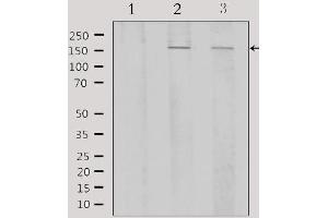 Western Blotting (WB) image for anti-Activating Transcription Factor 7 (ATF7) (N-Term) antibody (ABIN6256915)