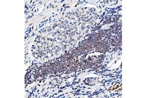 IHC analysis of NR3C1 using anti-NR3C1 antibody (ABIN3043453).