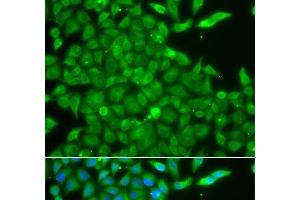 Immunofluorescence analysis of A549 cells using CSNK1G2 Polyclonal Antibody (Casein Kinase 1 gamma 2 抗体)