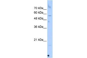 WB Suggested Anti-SEPN1 Antibody Titration:  0. (SEPN1 抗体  (C-Term))