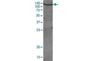 Western blot was performed using AOF2 polyclonal antibody  diluted 1 : 1,000 in TBS-Tween containing 5% skimmed milk. (LSD1 抗体)