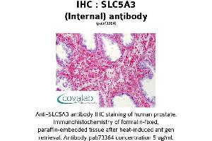 Image no. 1 for anti-Solute Carrier Family 5 Member 3 (SLC5A3) (Internal Region) antibody (ABIN1739401) (SLC5A3 抗体  (Internal Region))