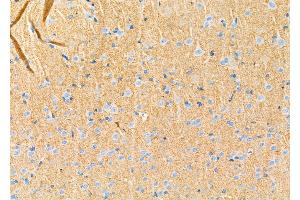 ABIN6264742 and ABIN6272414 at 1/100 staining Rat brain tissue by IHC-P. (RHOG 抗体  (Internal Region))