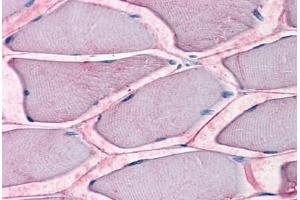 Human Skeletal Muscle: Formalin-Fixed, Paraffin-Embedded (FFPE) (SLC1A5 抗体  (Internal Region))
