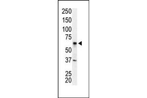 Western blot analysis of anti-IRAK2 Pab (ABIN392234 and ABIN2841928) in Jurkat cell lysate. (IRAK2 抗体  (N-Term))