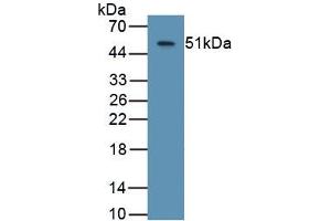 Detection of Recombinant ASPH, Human using Monoclonal Antibody to Aspartate Beta Hydroxylase (ASPH) (Aspartate beta Hydroxylase 抗体  (AA 345-758))