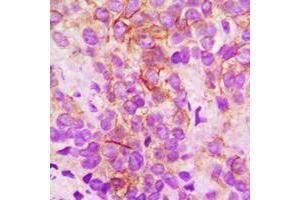 Immunohistochemistry (IHC) image for anti-Cytochrome P450, Family 2, Subfamily B, Polypeptide 6 (CYP2B6) (Center) antibody (ABIN7295442)