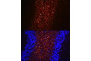 Immunofluorescence (IF) image for anti-Neurofilament, Heavy Polypeptide (NEFH) (AA 821-1020) antibody (ABIN6144512)