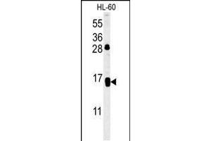 Western blot analysis in HL-60 cell line lysates (35ug/lane). (CD69 抗体  (AA 119-148))