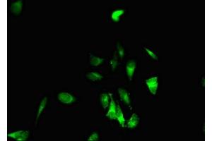 Immunofluorescent analysis of Hela cells using ABIN7151870 at dilution of 1:100 and Alexa Fluor 488-congugated AffiniPure Goat Anti-Rabbit IgG(H+L) (EPH Receptor B6 抗体  (AA 410-553))