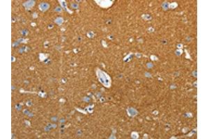 The image on the left is immunohistochemistry of paraffin-embedded Human brain tissue using ABIN7192659(SSTR4 Antibody) at dilution 1/25, on the right is treated with synthetic peptide. (SSTR4 抗体)