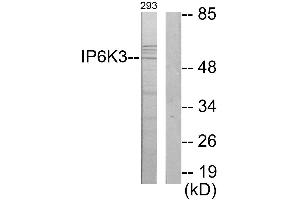 Immunohistochemistry analysis of paraffin-embedded human brain tissue using IP6K3 antibody. (IP6K3 抗体)