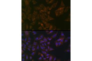 Immunofluorescence analysis of U-2 OS cells using Folate Binding Protein(FBP) / FOLR1 Rabbit pAb (ABIN7267224) at dilution of 1:100 (40x lens). (FOLR1 抗体  (AA 25-93))