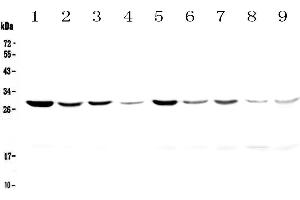 Western blot analysis of 14-3-3 zeta/delta using anti-14-3-3 zeta/delta antibody . (14-3-3 zeta 抗体)