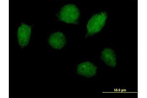 Immunofluorescence of purified MaxPab antibody to HOXA1 on HeLa cell.