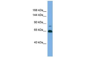 Western Blotting (WB) image for anti-Zinc Finger Protein 676 (ZNF676) (Middle Region) antibody (ABIN2787553) (ZNF676 抗体  (Middle Region))