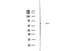 anti-Alanine Glyoxylate Aminotransferase 2 (AGXT2) (Internal Region) antibody