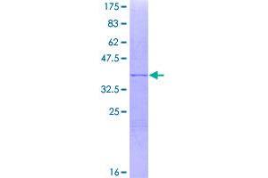 Melanoma Antigen Family F, 1 (MAGEF1) (AA 198-307) protein (GST tag)