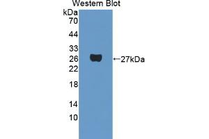Western blot analysis of the recombinant protein. (PAG1 抗体  (AA 138-357))