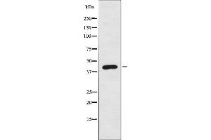 Western blot analysis of extracts from COLO cells, using DOK6 antibody. (DOK6 抗体  (Internal Region))
