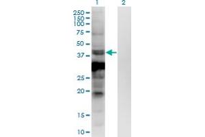 Western Blotting (WB) image for anti-Ankyrin Repeat and SOCS Box Containing 5 (ASB5) (AA 220-328) antibody (ABIN1774877)
