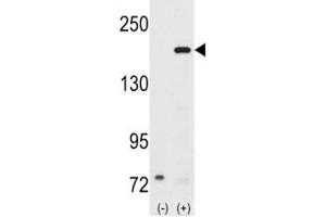 Western blot analysis of SRC-1 antibody and 293 cell lysate (2 ug/lane) either nontransfected (Lane 1) or transiently transfected with the NCOA1 gene (2). (NCOA1 抗体  (AA 186-214))
