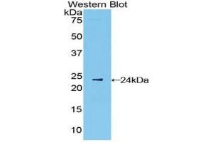 Western blot analysis of the recombinant protein. (IFNB1 抗体  (AA 22-187))
