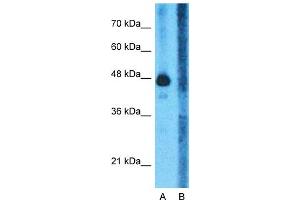 Host:  Rabbit  Target Name:  GLUD1  Sample Type:  Human Fetal Liver  Lane A:  Primary Antibody  Lane B:  Primary Antibody + Blocking Peptide  Primary Antibody Concentration:  1ug/ml  Peptide Concentration:  5ug/ml  Lysate Quantity:  25ug/lane/lane  Gel Concentration:  0. (GLUD1 抗体  (N-Term))