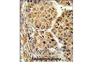 Immunohistochemistry (Paraffin-embedded Sections) (IHC (p)) image for anti-Cytochrome P450, Family 2, Subfamily C, Polypeptide 19 (CYP2C19) (AA 82-108), (N-Term) antibody (ABIN652231)