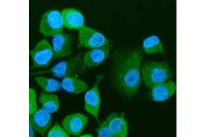 anti-Nicotinamide phosphoribosyltransferase (NAMPT) (AA 62-337) antibody