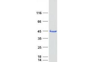 Western Blotting (WB) image for Spermine Synthase, SMS (SMS) protein (Myc-DYKDDDDK Tag) (ABIN2732576)